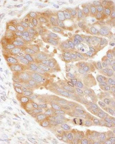 Immunohistochemistry (Formalin/PFA-fixed paraffin-embedded sections) - Anti-RPS3 antibody (AB140688)
