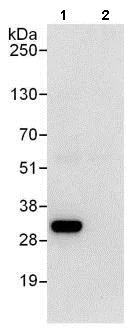 Immunoprecipitation - Anti-RPS3 antibody (AB140688)
