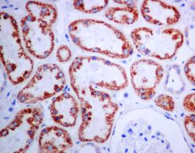 Immunohistochemistry (Formalin/PFA-fixed paraffin-embedded sections) - Anti-RPS3 antibody [EPR7808] - Ribosome Marker (AB128995), expandable thumbnail