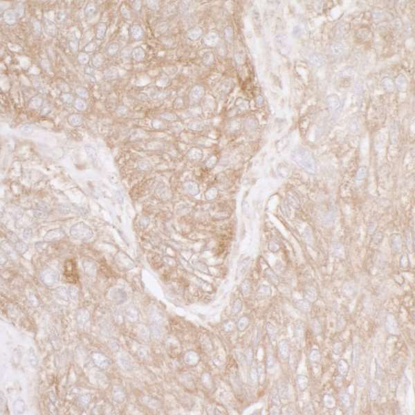 Immunohistochemistry (Formalin/PFA-fixed paraffin-embedded sections) - Anti-RPS3A antibody (AB264368)