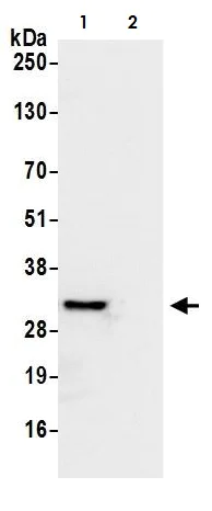 Immunoprecipitation - Anti-RPS3A antibody (AB264368)