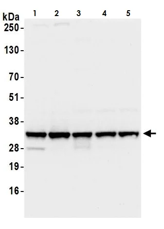 Western blot - Anti-RPS3A antibody (AB264368)