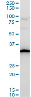 Western blot - Anti-RPS3A antibody - C-terminal (AB194670), expandable thumbnail