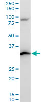 Western blot - Anti-RPS3A antibody - C-terminal (AB194670), expandable thumbnail