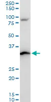 Western blot - Anti-RPS3A antibody - C-terminal (AB194670)