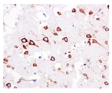 Immunohistochemistry (Formalin/PFA-fixed paraffin-embedded sections) - Anti-RPS3A antibody [EPR11982(B)] (AB171742)