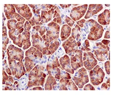 Immunohistochemistry (Formalin/PFA-fixed paraffin-embedded sections) - Anti-RPS3A antibody [EPR11982(B)] (AB171742)