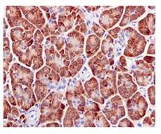 Immunohistochemistry (Formalin/PFA-fixed paraffin-embedded sections) - Anti-RPS3A antibody [EPR11982(B)] - BSA and Azide free (AB249646), expandable thumbnail