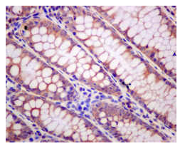 Immunohistochemistry (Formalin/PFA-fixed paraffin-embedded sections) - Anti-RPS3A antibody [EPR11983(B)] (AB176342)