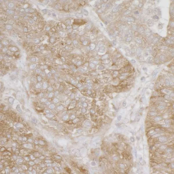 Immunohistochemistry (Formalin/PFA-fixed paraffin-embedded sections) - Anti-RPS3A antibody - N-terminal (AB226356)