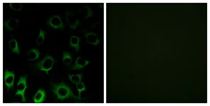 Immunocytochemistry/ Immunofluorescence - Anti-RPS4X/SCAR antibody (AB211427)