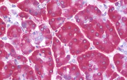 Immunohistochemistry (Formalin/PFA-fixed paraffin-embedded sections) - Anti-RPS4X/SCAR antibody (AB211427), expandable thumbnail