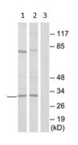 Western blot - Anti-RPS4X/SCAR antibody (AB211427), expandable thumbnail