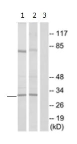 Western blot - Anti-RPS4X/SCAR antibody (AB211427)