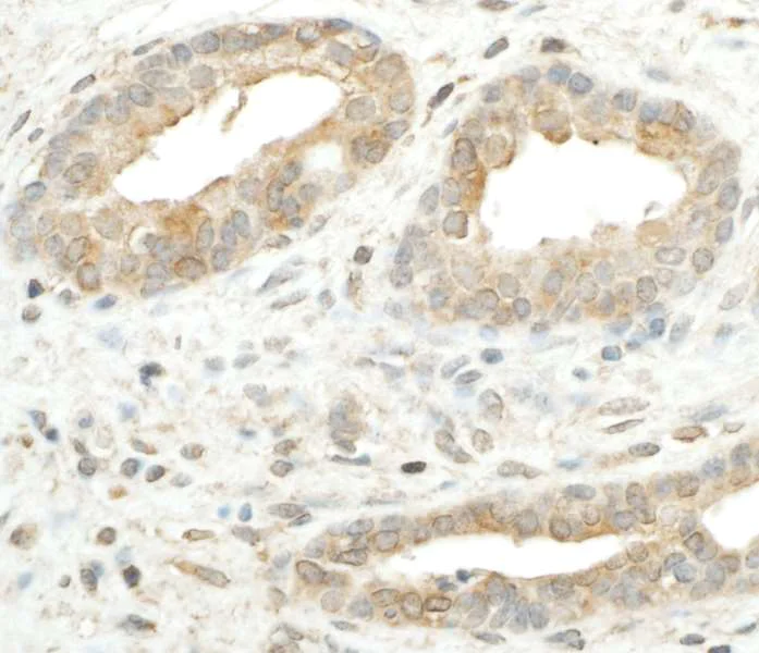 Immunohistochemistry (Formalin/PFA-fixed paraffin-embedded sections) - Anti-RPS5 antibody (AB168823)