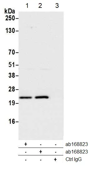Immunoprecipitation - Anti-RPS5 antibody (AB168823)