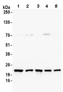 Western blot - Anti-RPS5 antibody (AB168823)
