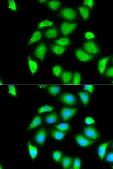 Immunocytochemistry/ Immunofluorescence - Anti-RPS5 antibody (AB210745)