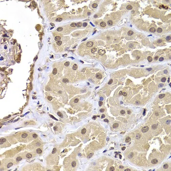 Immunohistochemistry (Formalin/PFA-fixed paraffin-embedded sections) - Anti-RPS5 antibody (AB210745)