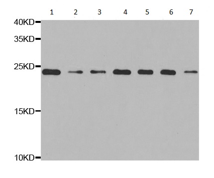 Western blot - Anti-RPS5 antibody (AB210745)