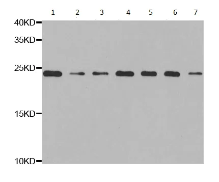 Western blot - Anti-RPS5 antibody (AB210745)