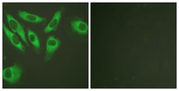 Immunocytochemistry/ Immunofluorescence - Anti-RPS6 antibody (AB127980), expandable thumbnail