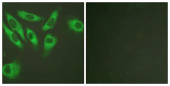 Immunocytochemistry/ Immunofluorescence - Anti-RPS6 antibody (AB127980)