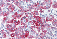 Immunohistochemistry (Formalin/PFA-fixed paraffin-embedded sections) - Anti-RPS6 antibody (AB127980), expandable thumbnail