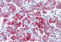 Immunohistochemistry (Formalin/PFA-fixed paraffin-embedded sections) - Anti-RPS6 antibody (AB127980)