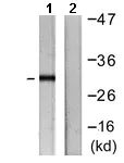 Western blot - Anti-RPS6 antibody (AB127980)