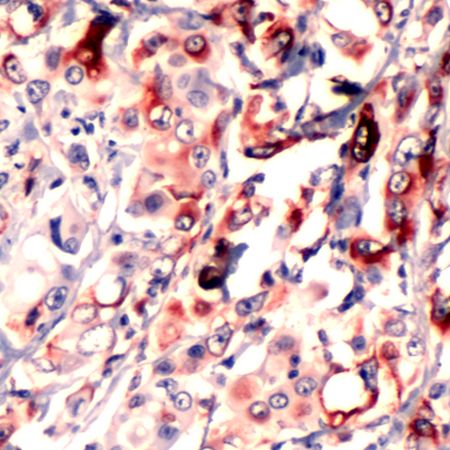 Immunohistochemistry (Formalin/PFA-fixed paraffin-embedded sections) - Anti-RPS6 antibody (AB231463)