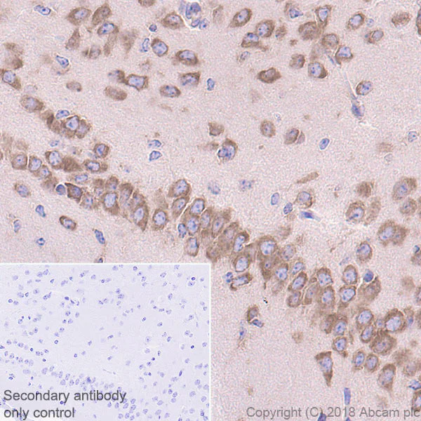 Immunohistochemistry (Formalin/PFA-fixed paraffin-embedded sections) - Anti-RPS6 antibody [EPR22168] - BSA and Azide free (AB236454)
