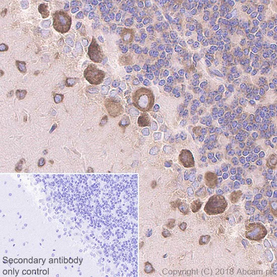 Immunohistochemistry (Formalin/PFA-fixed paraffin-embedded sections) - Anti-RPS6 antibody [EPR22168] - Ribosome Marker (AB225676)
