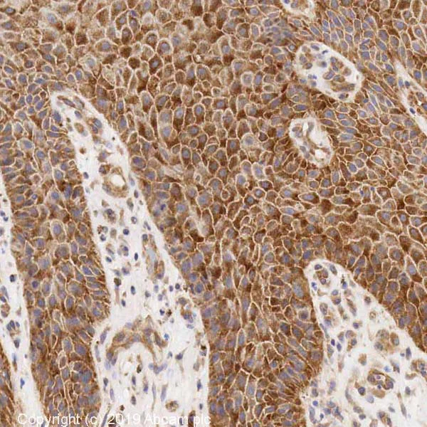 Immunohistochemistry (Formalin/PFA-fixed paraffin-embedded sections) - Anti-RPS6 antibody - Ribosome Marker (AB40820)