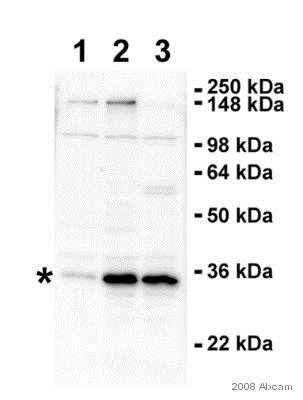 Western blot - Anti-RPS6 antibody - Ribosome Marker (AB40820)