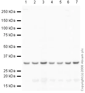 Western blot - Anti-RPS6 antibody - Ribosome Marker (AB40820)