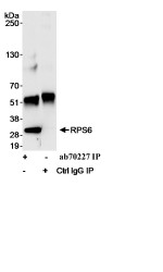Immunoprecipitation - Anti-RPS6 antibody - Ribosome Marker (AB70227)