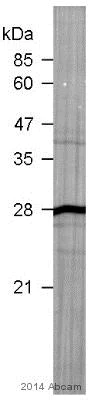 Western blot - Anti-RPS6 antibody - Ribosome Marker (AB70227)