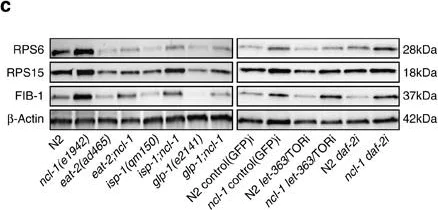 Western blot - Anti-RPS6 antibody - Ribosome Marker (AB70227)