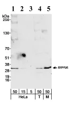 Western blot - Anti-RPS6 antibody - Ribosome Marker (AB70227)