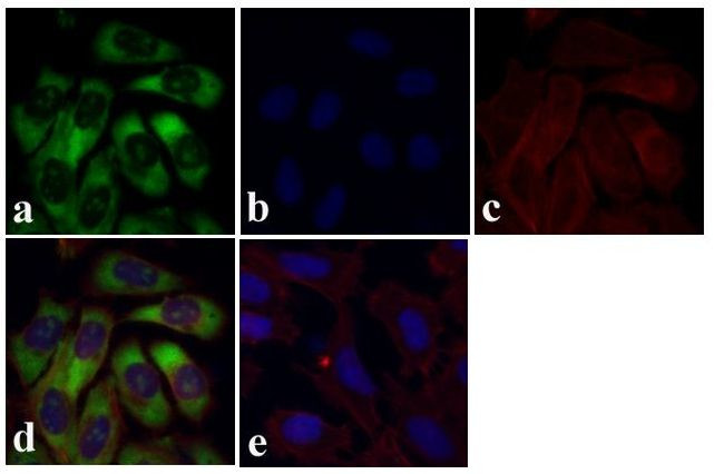 Immunocytochemistry/ Immunofluorescence - Anti-RPS6 antibody [RP23040083] (ab313428), expandable thumbnail