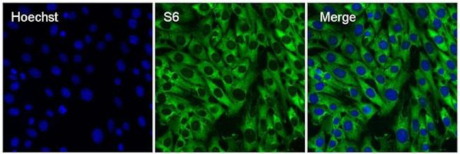 Immunocytochemistry/ Immunofluorescence - Anti-RPS6 antibody [RP23040083] (AB313428), expandable thumbnail