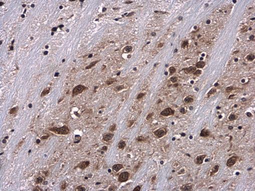 Immunohistochemistry (Formalin/PFA-fixed paraffin-embedded sections) - Anti-RPS6 (phospho S235) antibody - C-terminal (AB227005)