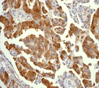Immunohistochemistry (Formalin/PFA-fixed paraffin-embedded sections) - Anti-RPS6 (phospho S235) antibody [EP1338(2)Y] - BSA and Azide free (AB213165)