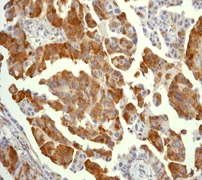 Immunohistochemistry (Formalin/PFA-fixed paraffin-embedded sections) - Anti-RPS6 (phospho S235) antibody [EP1338(2)Y] - Ribosome Marker (AB80158)