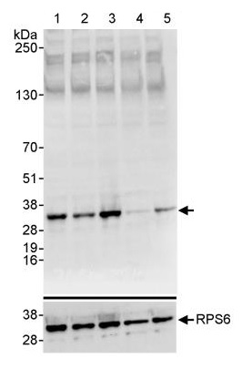 Western blot - Anti-RPS6 (phospho S235 + S236) antibody (AB264135)