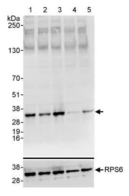 Western blot - Anti-RPS6 (phospho S235 + S236) antibody (AB264135)