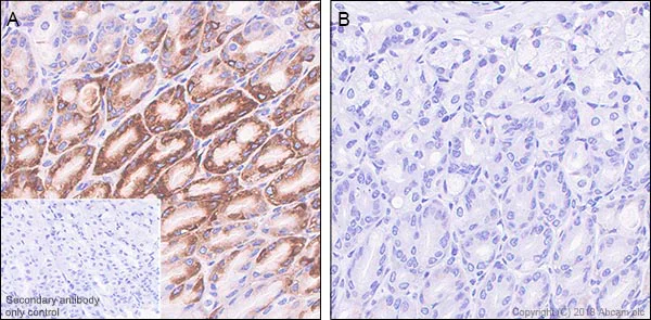 Immunohistochemistry (Formalin/PFA-fixed paraffin-embedded sections) - Anti-RPS6 (phospho S235 + S236) antibody [SP50] (AB101691)