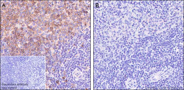 Immunohistochemistry (Formalin/PFA-fixed paraffin-embedded sections) - Anti-RPS6 (phospho S235 + S236) antibody [SP50] (AB101691)