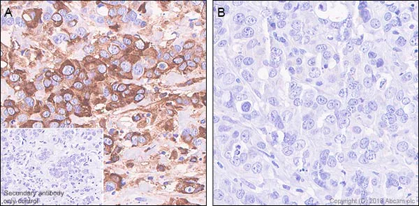 Immunohistochemistry (Formalin/PFA-fixed paraffin-embedded sections) - Anti-RPS6 (phospho S235 + S236) antibody [SP50] (AB101691)